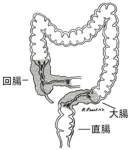 と は 病 クローン