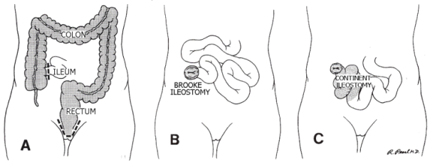 ��ᇐ��咰���@��p