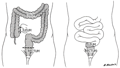 ��ᇐ��咰���@��p