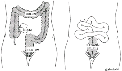 ��ᇐ��咰���@��p