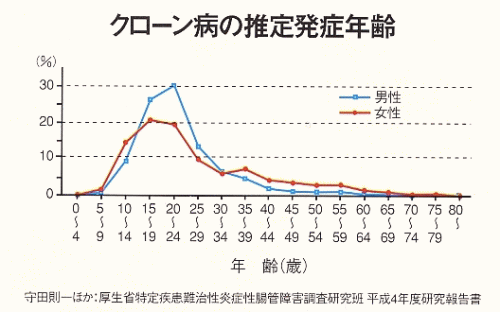 クローン病の推定発祥年齢