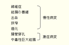 潰瘍性大腸炎