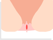 裂肛